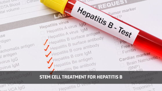 Stem Cells Therapy for Hepatitis B - Advancells