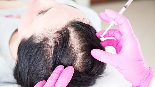 stem cell therapy for hair loss treatment