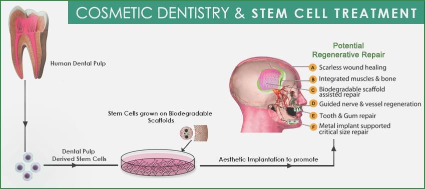 Dental Pulp Stem Cell Process