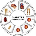 Diabetes and complications