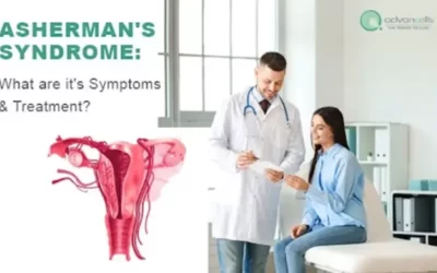 Asherman’s Syndrome: What are it’s Symptoms, & Treatment?