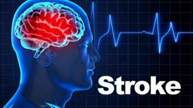 Stem Cell Therapy for Stroke
