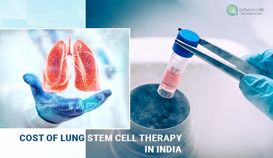 Cost of Lung Stem Cell Therapy In India