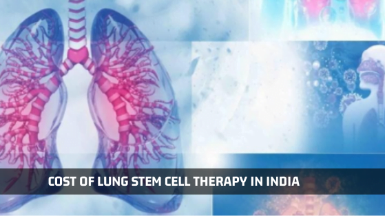 Cost of Lung Stem Cell Therapy In India