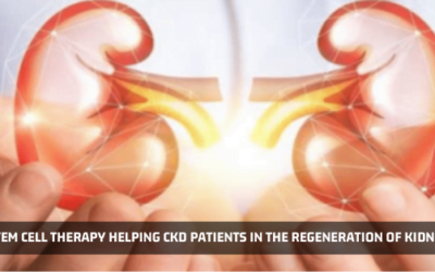 Stem Cell Therapy Helping Chronic Kidney Disease Patients In The Regeneration Of Kidney