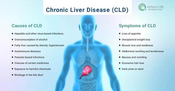 Chronic Liver Disease (CLD) - Causes, Symptoms, and Treatment