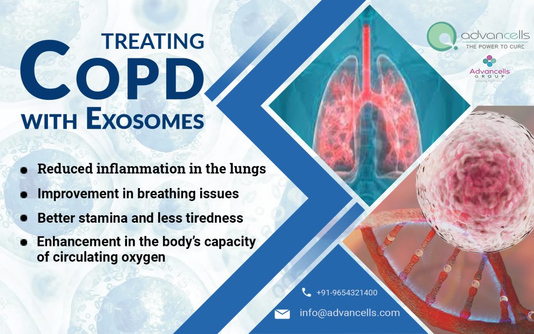 Exosomes for COPD and Lung Disease