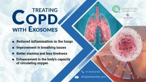 Treating COPD With Exosomes