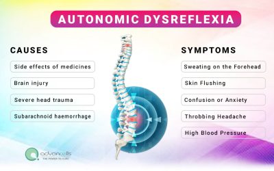 Autonomic Dysreflexia In Spinal Cord Injury