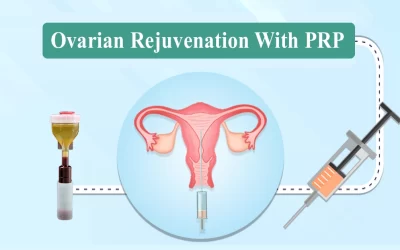 Ovarian Rejuvenation With PRP