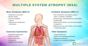 Multiple System Atrophy Symptoms Types