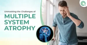 Multiple System Atrophy Unraveling the Challenges of a Rare Neurological Disorder