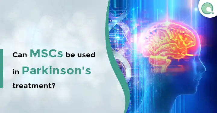 Can MSCs be used in Parkinson's treatment