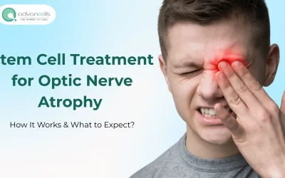 Stem Cell Treatment for Optic Nerve Atrophy: How It Works & What to Expect?